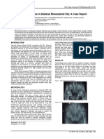 Girdle Stone Procedure in Bilateral Rheumatoid Hip: A Case Report