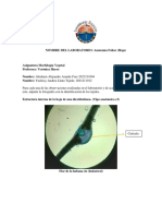 Informe Hoja