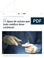 11 Tipos de Sutura Que Todo Médico Deve Conhecer - PEBMED