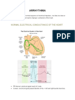 Arrhythmia: Normal Electrical Conductance of The Heart