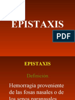 EPISTAXIS