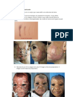 Cicatrización y Fases de La Cicatrización