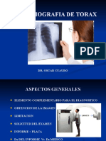 Radiografia de Torax (Clase)