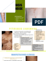 T9u1m1 Pitiriasis Liquenoide