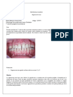 Protocolo Clinico de Regeneracion Osea