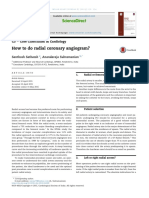 How To Do Radial Coronary Angiogram