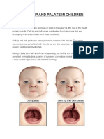 Cleft Palate and Lips