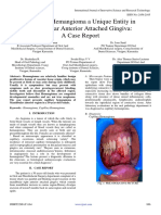 Capillary Hemangioma A Unique Entity in Mandibular Anterior Attached Gingiva A Case Report