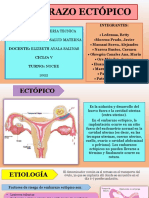 Embarazo Eptopico