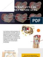 Fisioterapia en Las Lesiones Meniscales