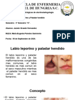 Labio Leporino y Paladar Hendido