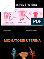 Miomatosis Uterina