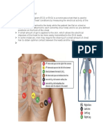 ECG Monitoring