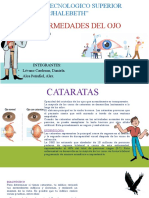 Enfermedades Del Ojo