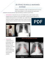 Teorico Imagenes Torax