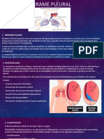 Derrame Pleural