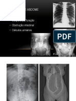 Abdo Agudo Não Traumático 2