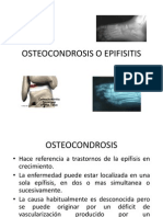 Osteocondrosis o Epifisitis