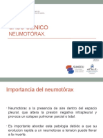 S10-PRA - PPT - Caso Clinico Neumotórax FN 2022