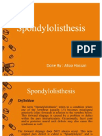 21 - Spondylolisthesis - D3