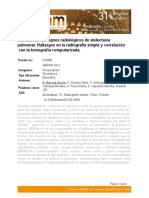 Revisión de Los Signos Radiológicos de Atelectasia Pulmonar. Hallazgos en La Radiografía Simple y Correlación Con La Tomografía Computarizada