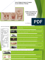 Complicaciones de Estomas