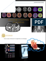 Anatomia Seccional Del Corazón Pet CT