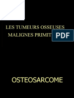 Les Tumeurs Osseuses Malignes Primitives