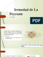 Enfermedad de Peyronie