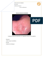 Proceso Atencion de Enfermeria Ulcera Gastrica