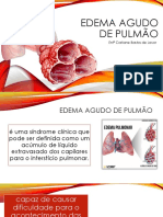 Edema Agudo de Pulmão