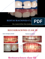 Restauraciones Clase Iii