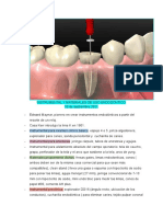 Endodoncia Basica