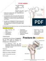 FX de Cadera