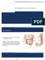 Enfermedad Diverticular Colónica