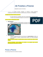 Selladores de Fosetas y Fisuras