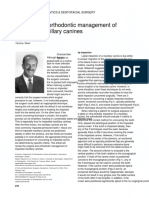 Surgical and Orthodontic Management of Impacted Maxillary Canines (Clasico)