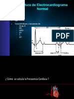 Clase 6 Lectura de Electrocardiogarma