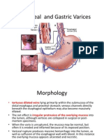 Esophageal and Gastric Varices