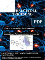 Neuralgia Del Trigemino Exposición