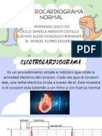 Electrocadiograma Normal