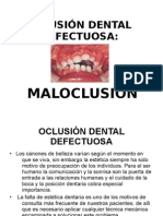 1.5 Oclusin Dental Defectuosa 2