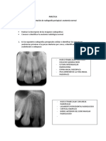 Interpretacion de RX Periapical