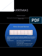 Arritmias 202201