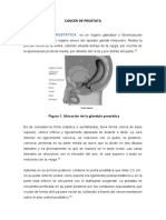 Cáncer de Prostata