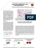 Anemia Sideroblástica Por Cloranfedicol