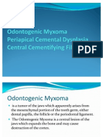 Odontogenic Myxoma