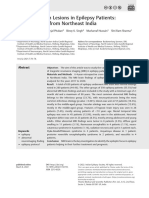 Epilepsy and Brain Lesion