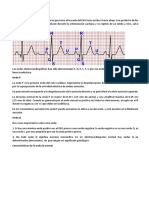 Vectocardiografia