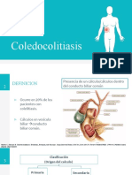 Coledocolitiasis